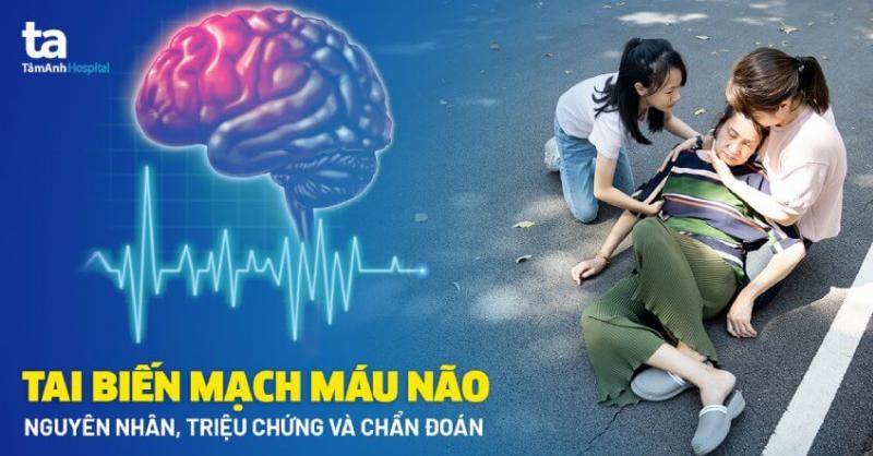Bệnh Án Tai Biến Mạch Máu Não: Hiểu Rõ Để Đối Phó Kịp Thời