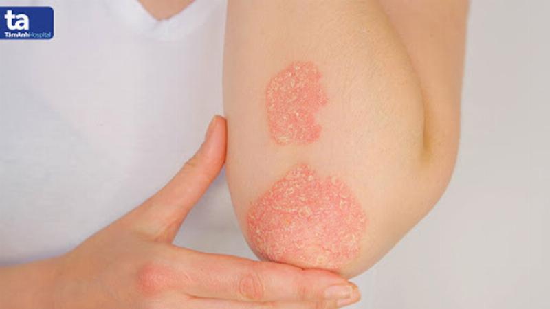 Hình ảnh minh họa quá trình hỏi bệnh sử chi tiết trong trường hợp viêm khớp dạng thấp