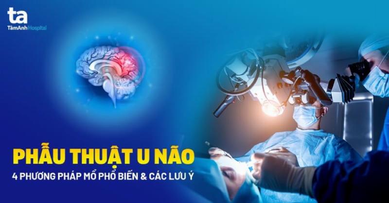 dao-mo-sieu-am-kim-nho-va-kep-mach-mau-sieu-nho-trong-phau-thuat-than-kinh