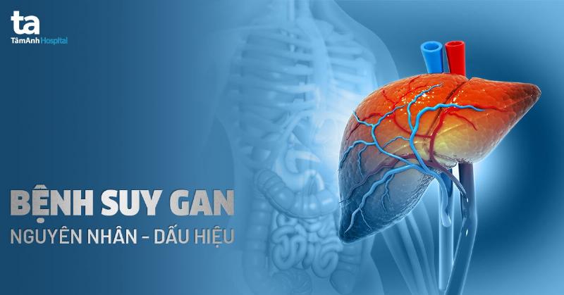 Hinh anh mo ta gan bi suy chuc nang voi cac vung ton thuong va te bao gan hu hai trong hoi chung suy te bao gan