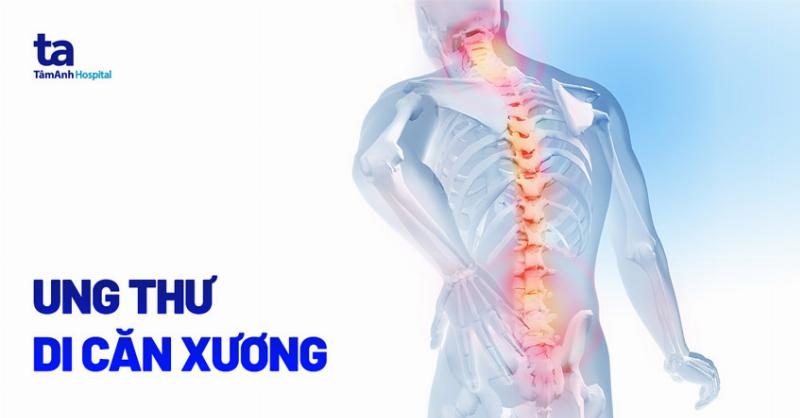 Những hạn chế của cân xương tính số