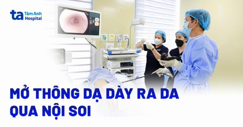 Hinh anh minh hoa cac bien chung co the xay ra khi dat sonde da day