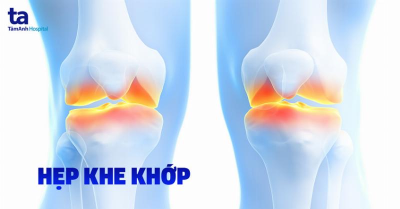 Hình ảnh X-quang khớp gối bình thường với các xương thẳng hàng, khe khớp đều.