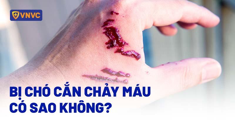 Mơ thấy bị chó cắn chảy máu tổn thương