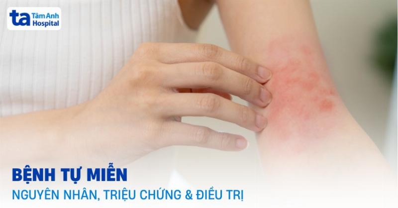 Hình ảnh biểu đồ minh họa các yếu tố ảnh hưởng đến tiên lượng bệnh viêm khớp dạng thấp và tầm quan trọng của việc quản lý bệnh sớm