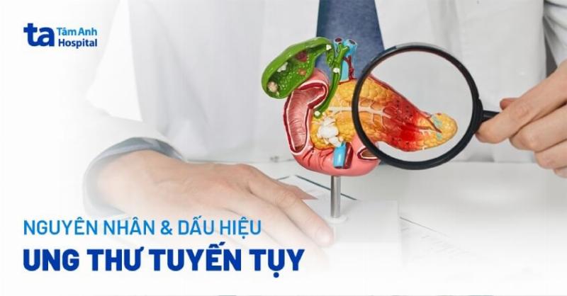 Biểu đồ minh họa yếu tố ảnh hưởng đến tiên lượng viêm tụy cấp theo mức độ nặng