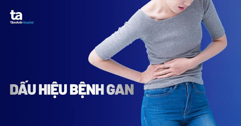 Hinh anh nguoi benh vang da vang mat dau hieu dien hinh cua suy te bao gan
