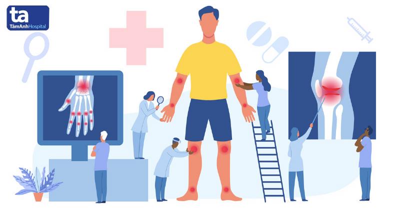 Hình ảnh minh họa các khớp bị ảnh hưởng bởi viêm khớp dạng thấp và tầm quan trọng của việc lập bệnh án chi tiết